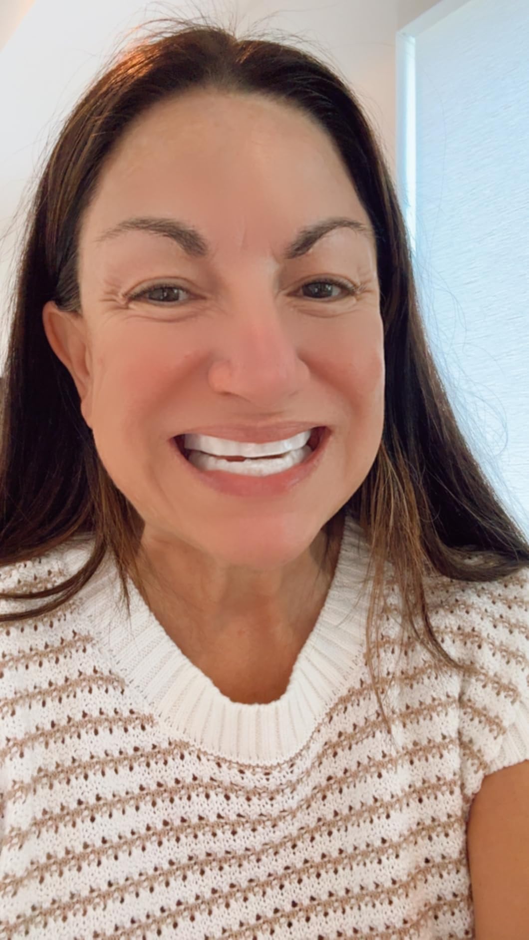 Opalescence Go 15% Prefilled Teeth Whitening Trays Kit - 15% Hydrogen Peroxide - (10 Treatments) Dentist Recommended - Made by Ultradent Products customer photo 1