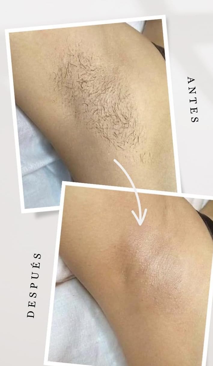 INIA Laser Hair Removal with Ice-Cooling Care for Women and Men, HAUTE Pro Painless at-Home IPL Hair Remover for Coarse Hair in Bikini All Body Areas, Latest Generation for Effective Results (Pink) customer photo 2