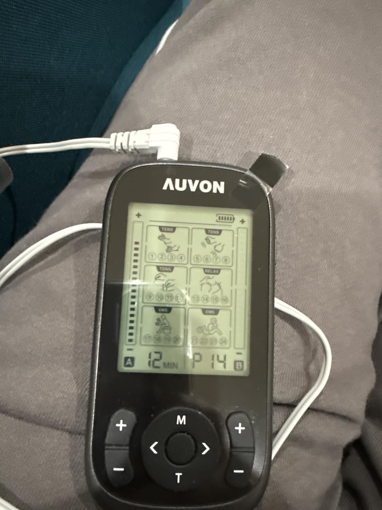 3-in-1 TENS Unit Muscle Stimulator, EMS Massage Machine with 40 Intensities for Gradual Shoulder, Sciatica, Back Pain Relief, 24 Modes Rechargeable Electronic Pulse Massager with 12 TENS Pads customer photo 2