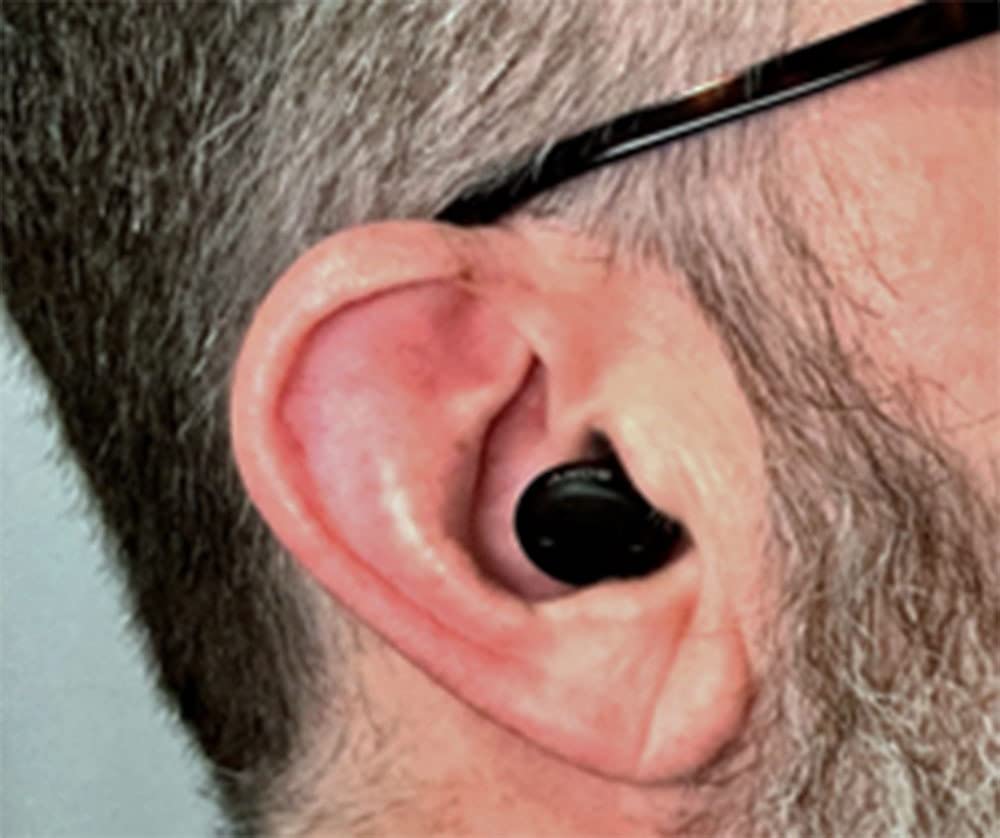 Sony CRE-E10 Self-Fitting OTC Hearing Aids for Mild to Moderate Hearing Loss, Prescription-Grade Sound Quality, Comfortable Earbud Design, Bluetooth Enabled for iOS, and Rechargeable Battery, Black customer photo 1